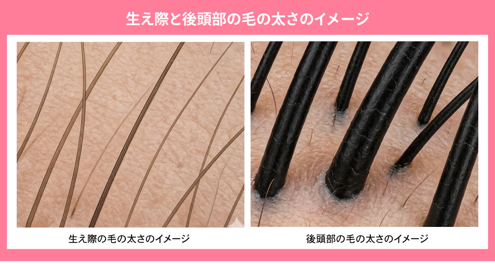 施術前に知っておきたい大切なポイント