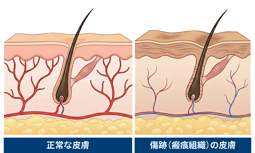 定着しにくい理由