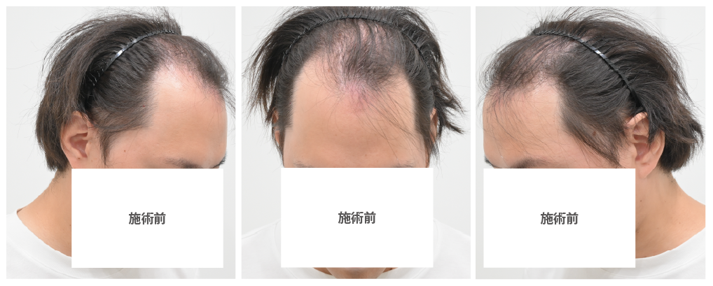 モニター様のご希望と治療内容