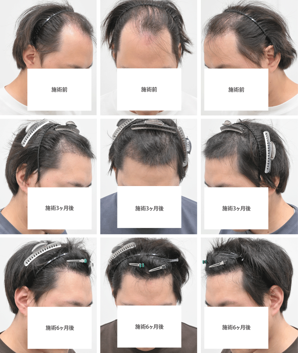 それでは、気になる術後の経過を見ていきましょう