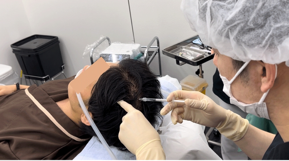 最短1ヶ月で生える