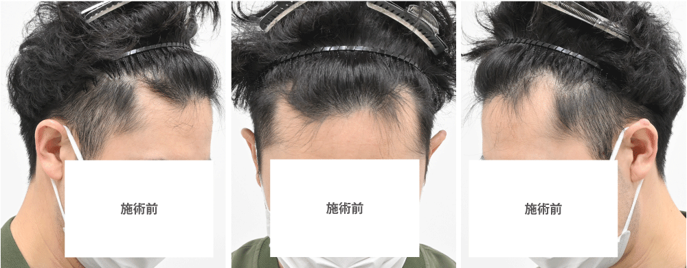 モニター様のご希望と治療内容