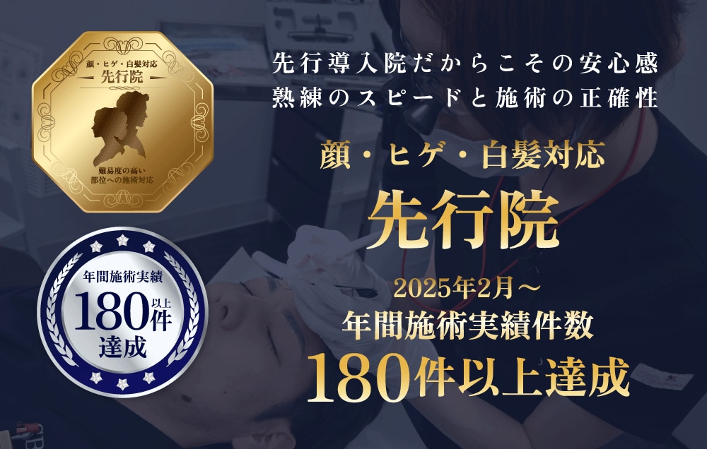 なぜ実績180件以上がすごいのか？