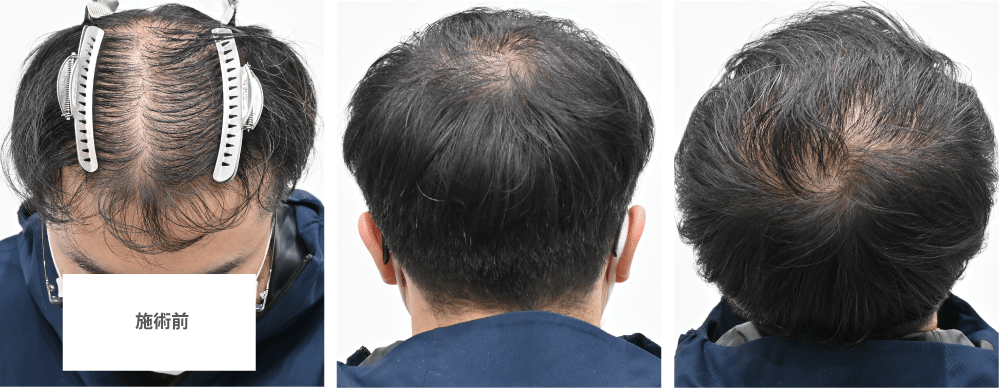 モニター様のご希望と治療内容
