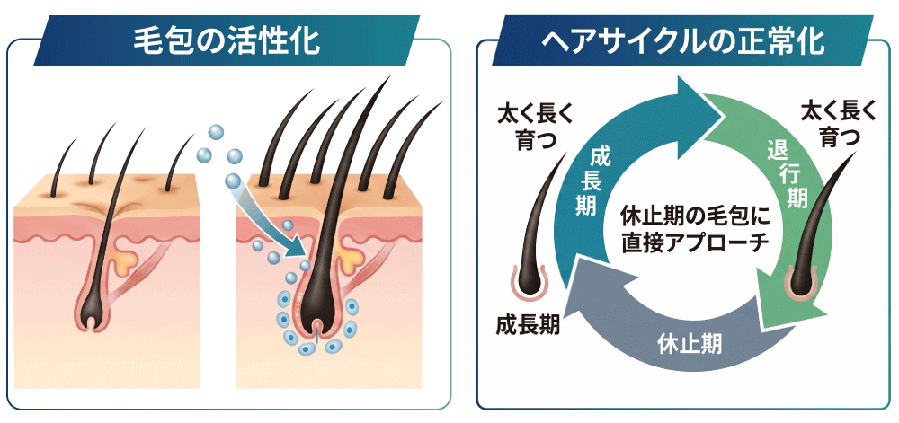 薄毛の再生治療の定義と仕組み