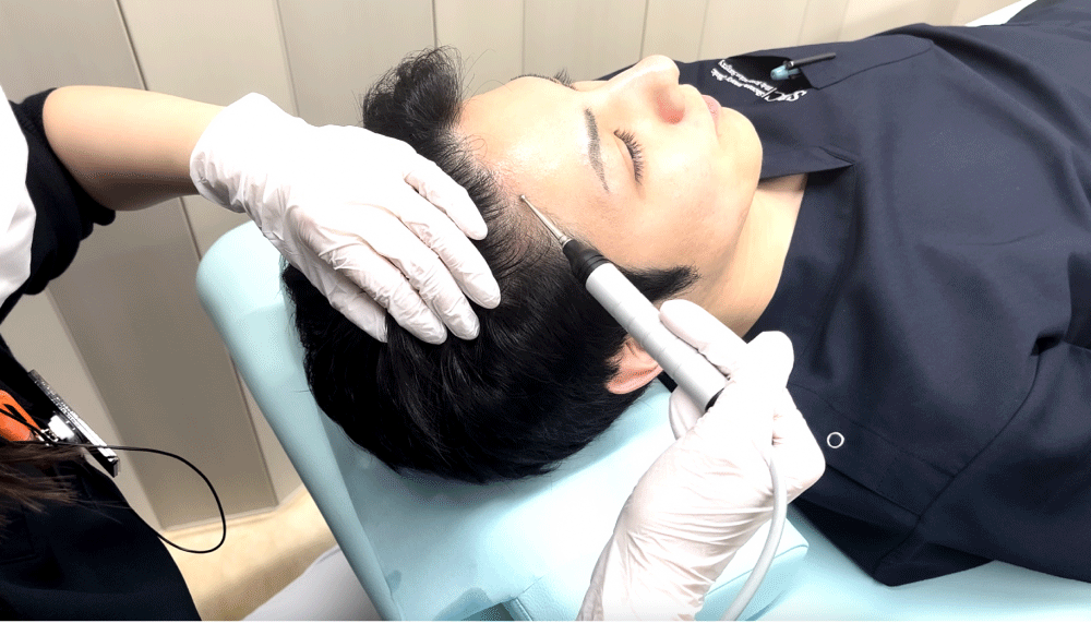エレクトロポレーションメソ
