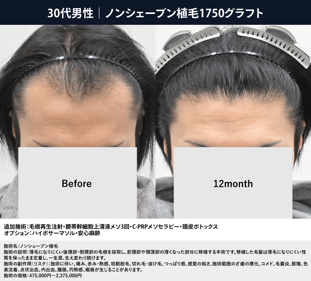 実際の症例