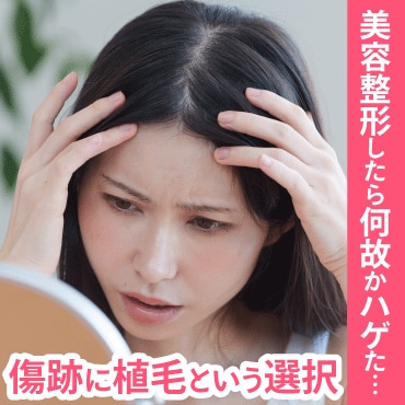 美容整形の傷跡・後遺症の脱毛は自毛植毛で！