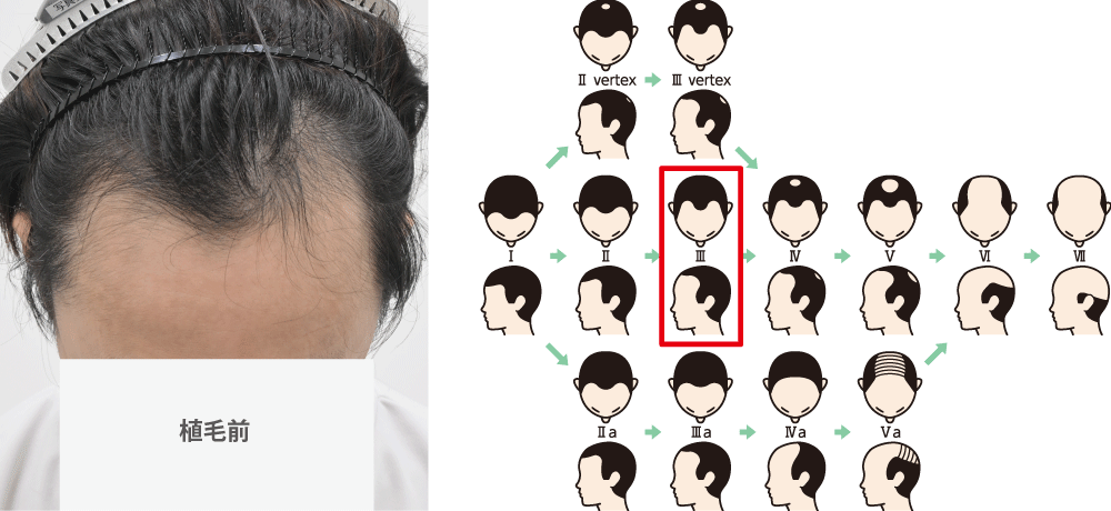 今回のミニター様は…
