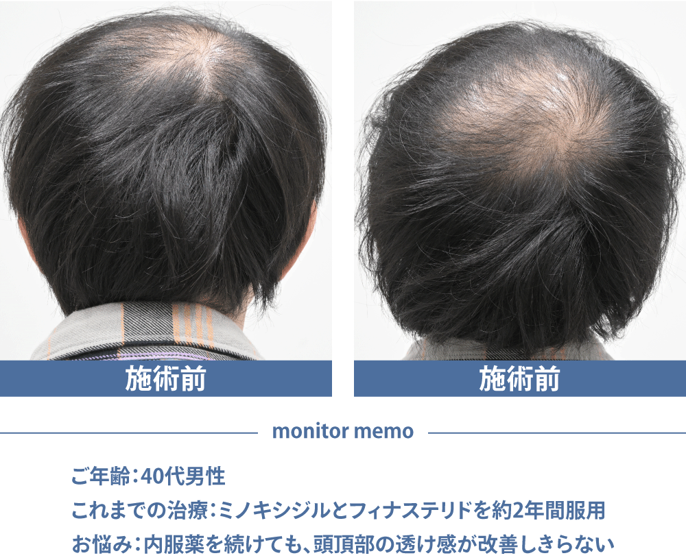 ご来院時の状態と治療内容