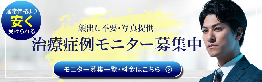 湘南AGAクリニック仙台院のモニター募集