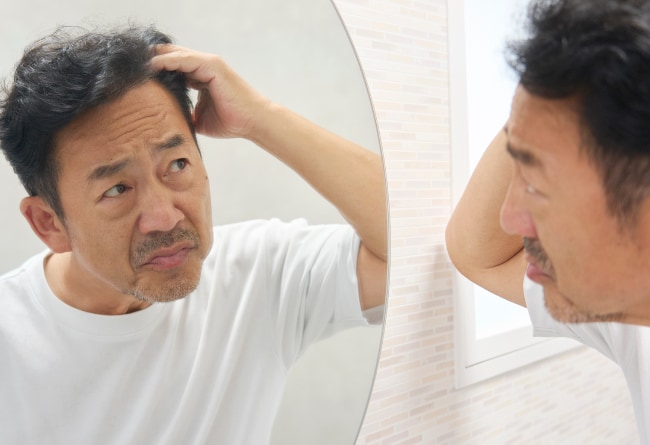 抜け毛を抑制したい方