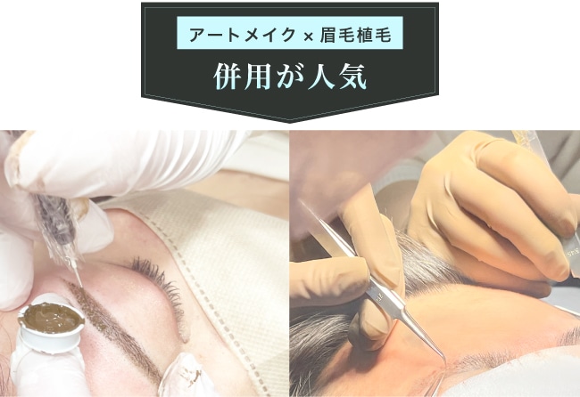 併用がおすすめなケース