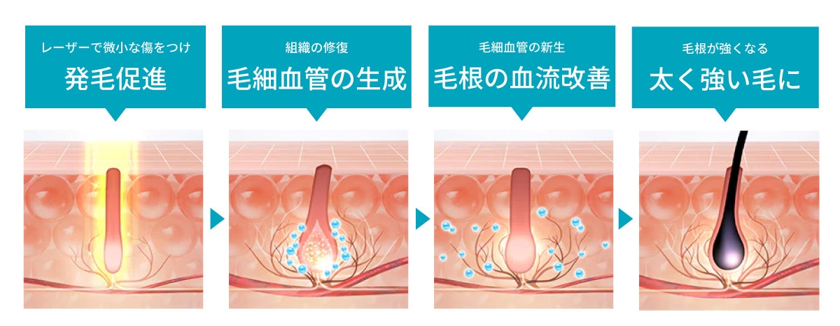 仕組みと効果