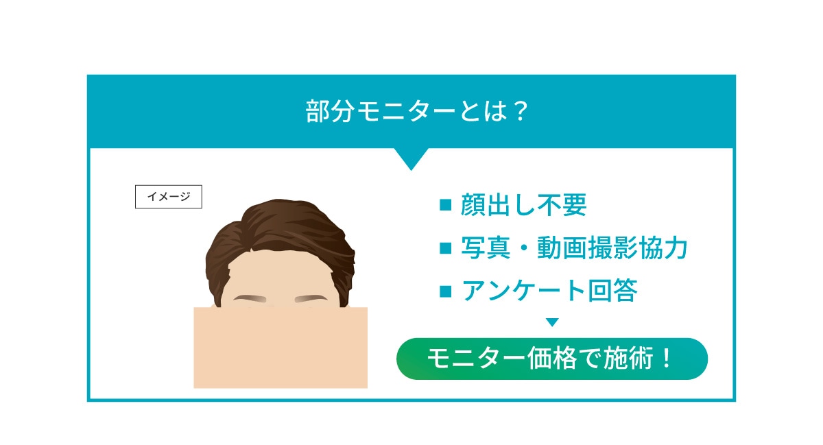 【バレない】ノンシェーブン植毛モニター募集中