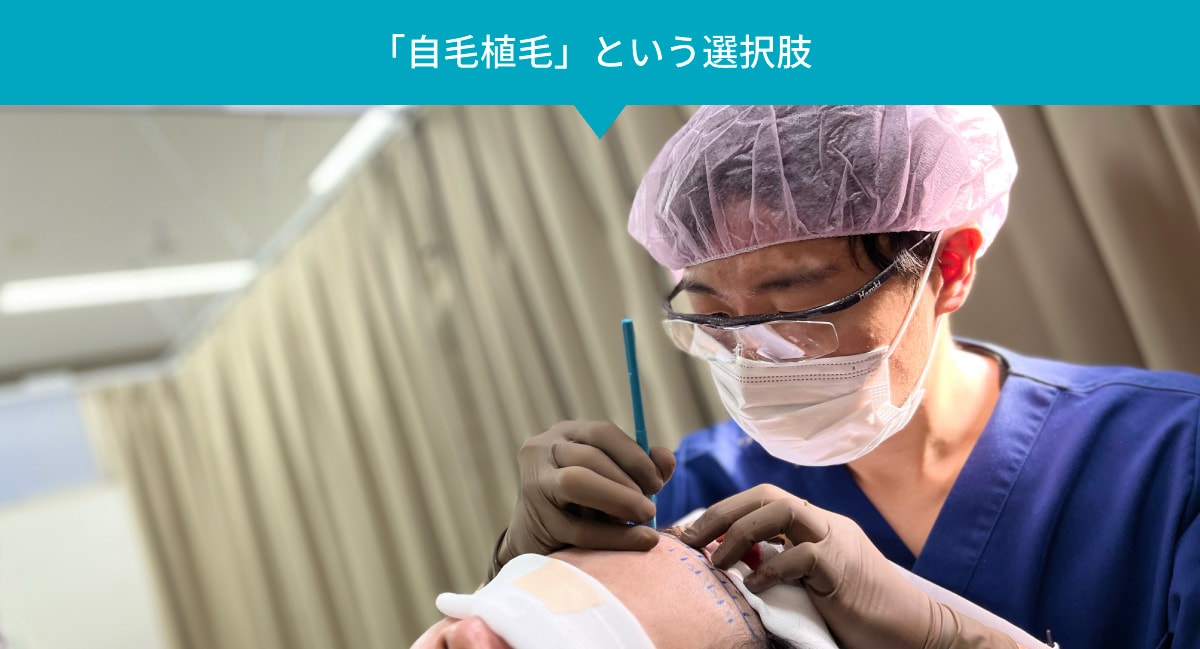 AGA治療薬以外の検討