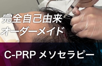 C-PRPメソセラピー