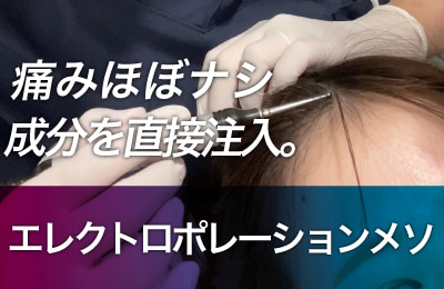 エレクトロポレーションメソ