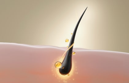 弱った毛根には、肥料（栄養）だけでは足りない