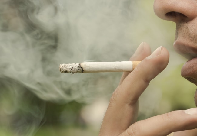 植毛の成功には術前・術後の禁煙が不可欠