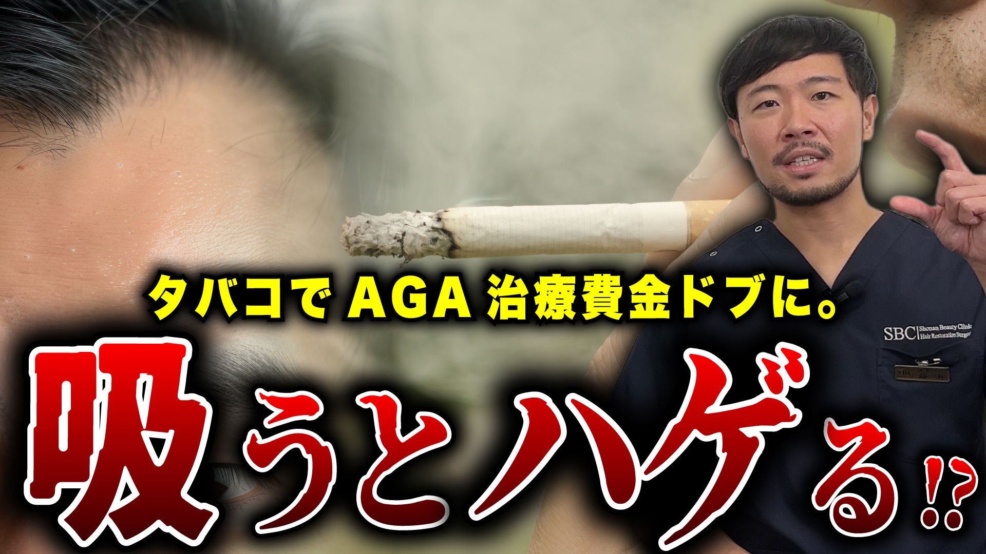 自毛植毛後のタバコは「生着率」を下げる？禁煙すべき理由とAGA治療への残酷な真実