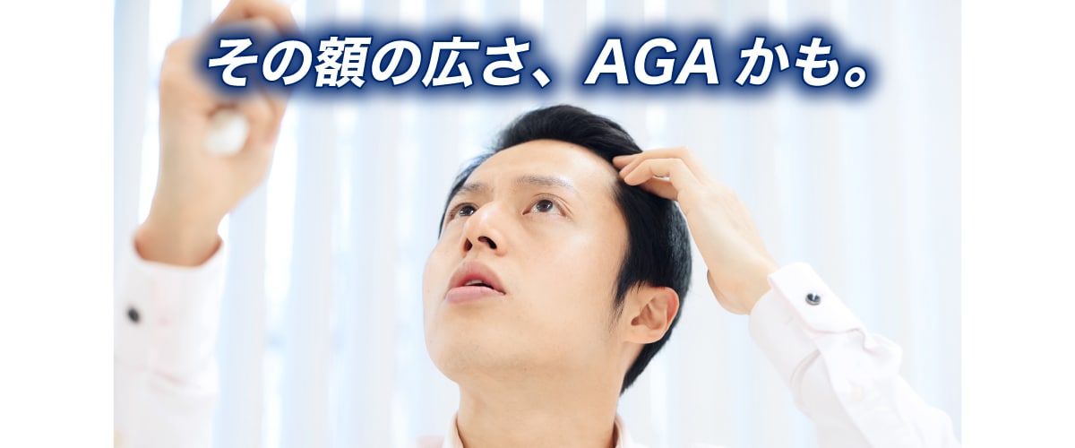 若年層の男性を悩ませる生え際の軟毛化