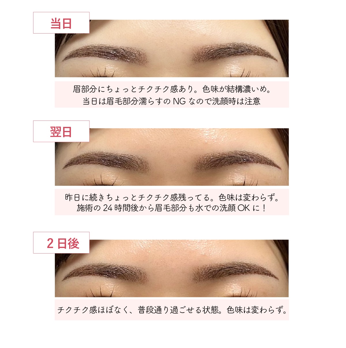 施術直後から2日目：色が最も濃く見える時期