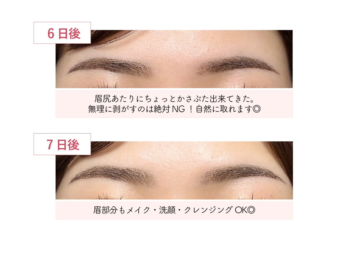 6日目から7日目：色味が落ち着き馴染む時期