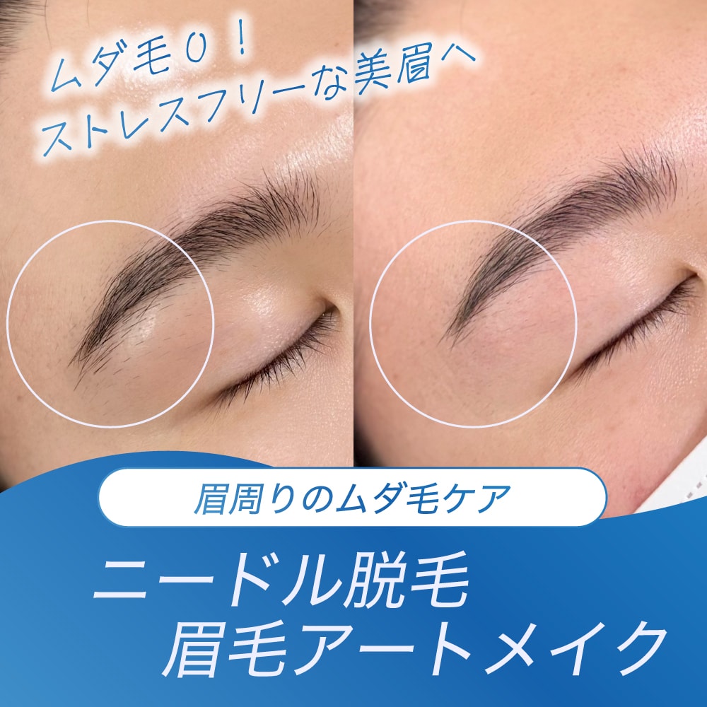 【仙台】眉毛周りのムダ毛処理から解放！アートメイク×ニードル脱毛でつくる「自己処理ゼロ」の理想眉