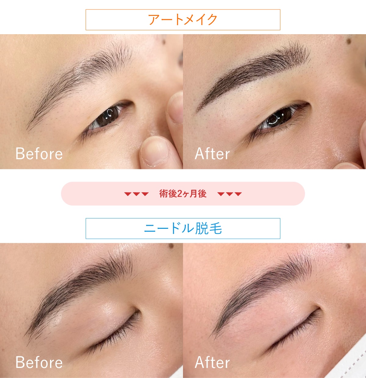 おすすめは「眉毛アートメイク」を先にする！
