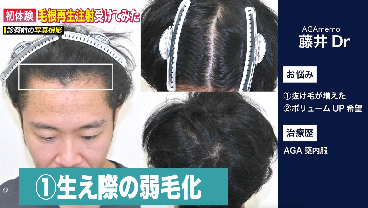 写真とマイクロスコープによる診察