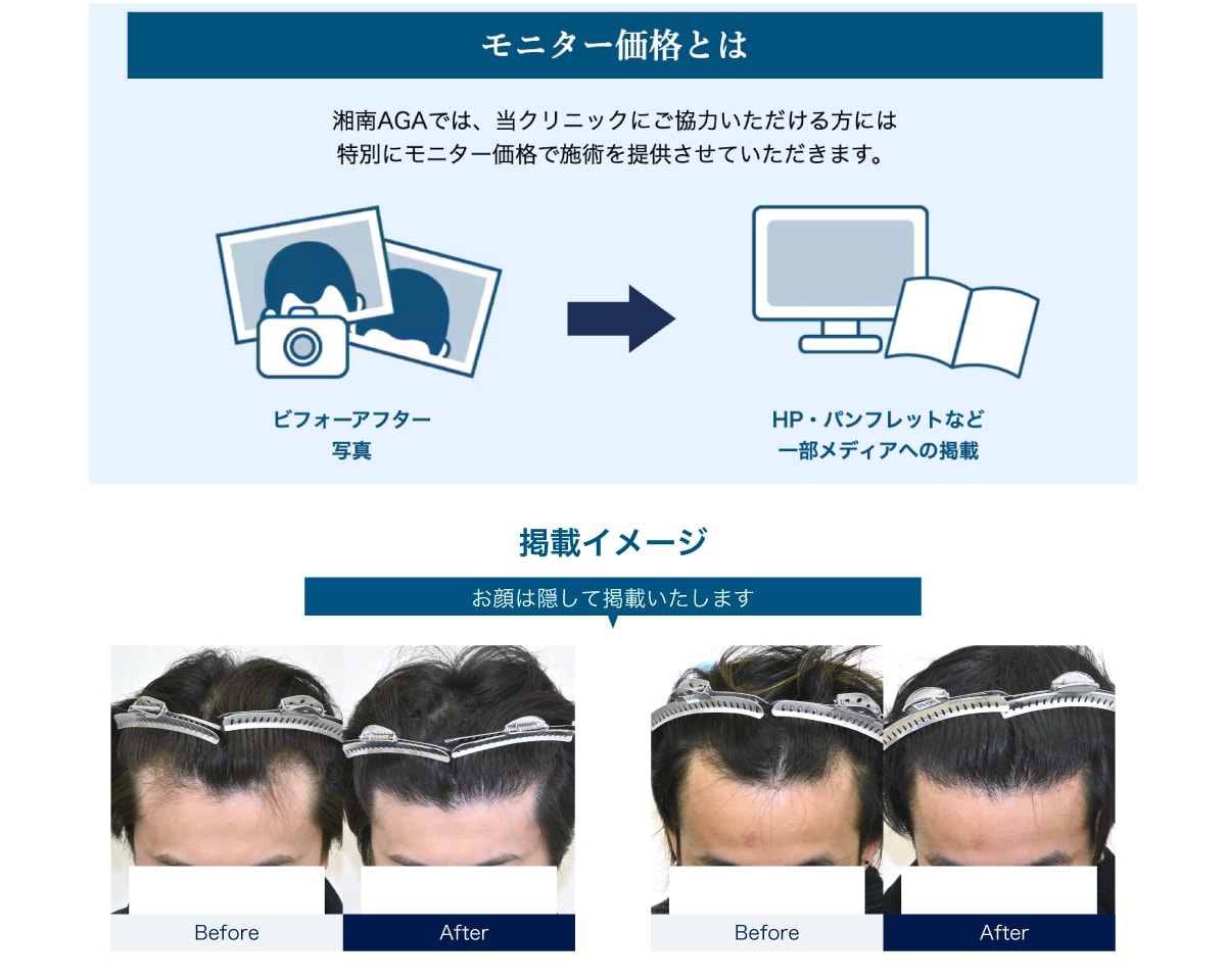 症例モニター制度を利用する