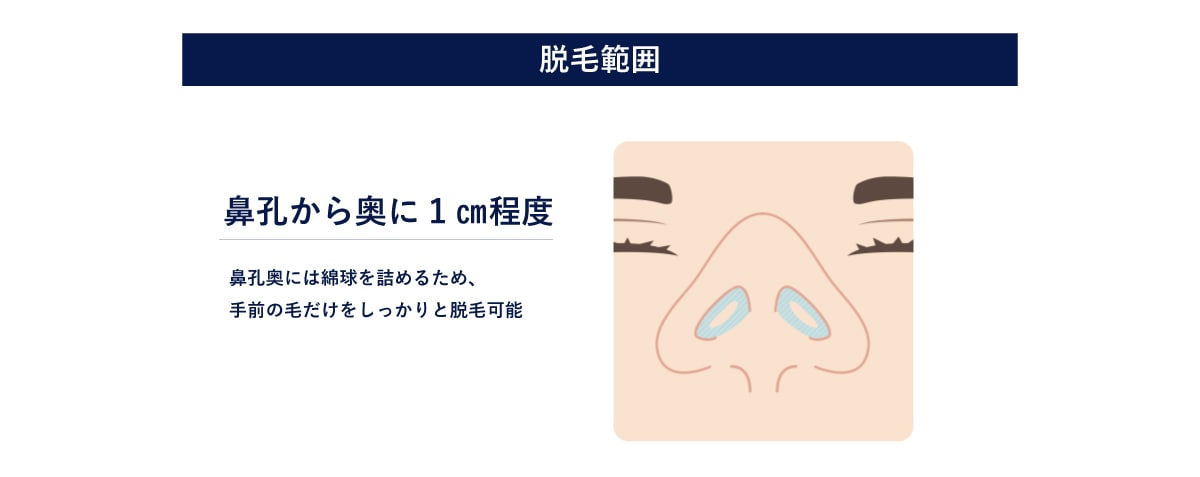 手前の見える部分だけの照射だから安心