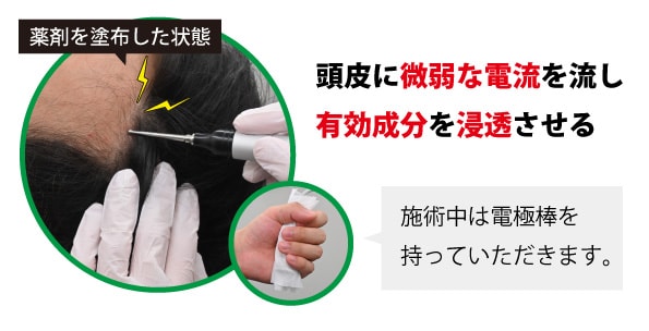 効果の違いは？ジェットメソからエレクトロポレーションメソに変更 