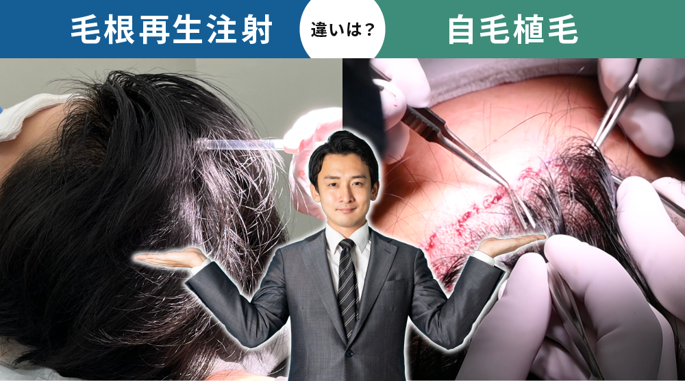 自毛植毛との違い