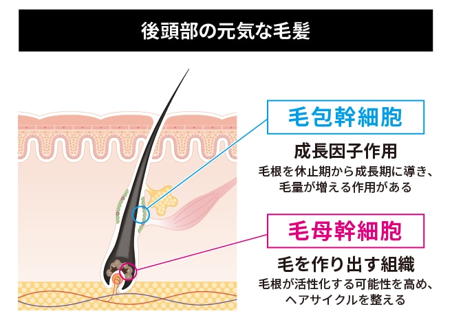 毛根再生注射とは