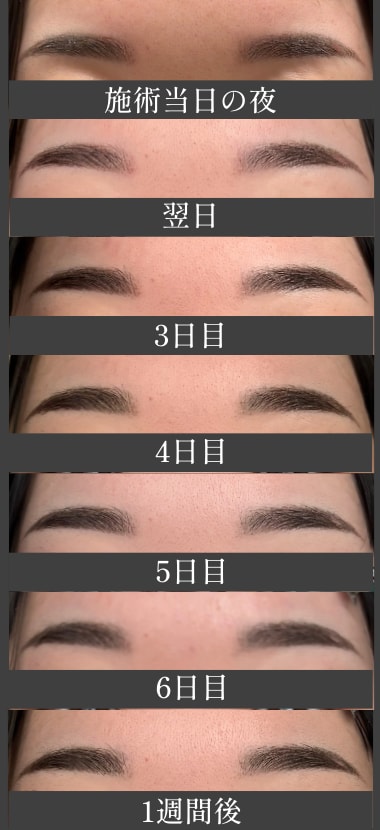 アートメイクのダウンタイム