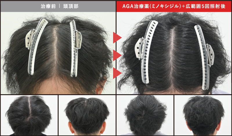 30代男性の症例