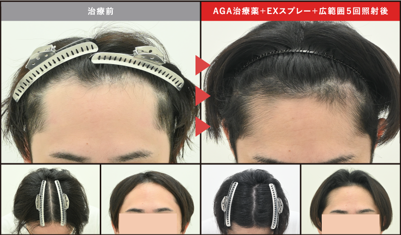 20代男性の症例