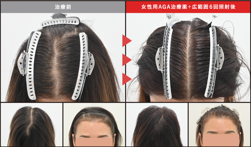 50代女性の症例