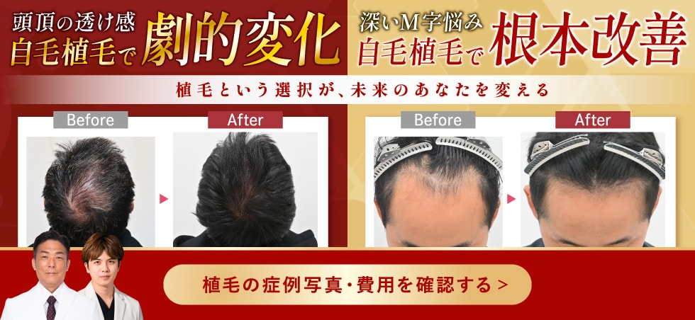 SBC育毛 湘南AGAクリニック新宿本院(東京)【公式】-AGA治療・薄毛治療・自毛植毛