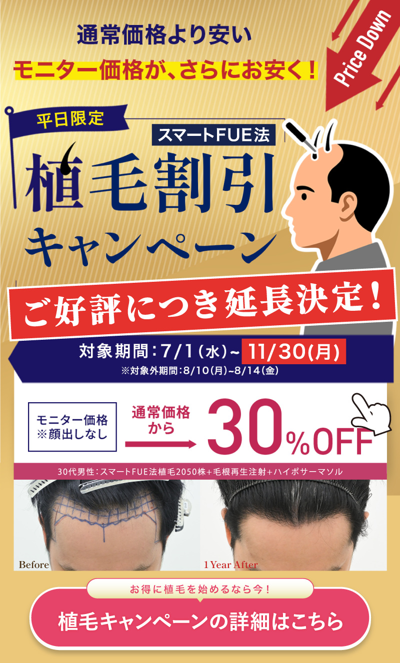 AGAキャンペーン