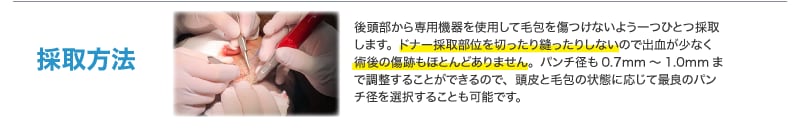 AGAキャンペーン