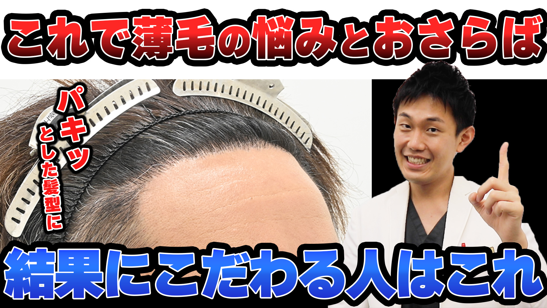 みっちり植毛