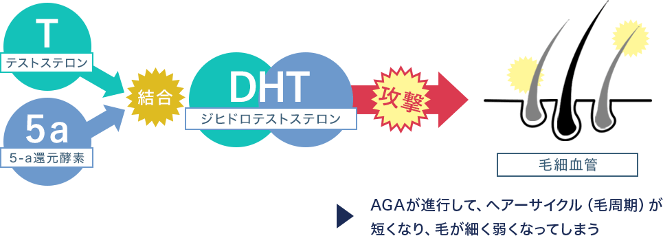 AGA進行の仕組み 画像