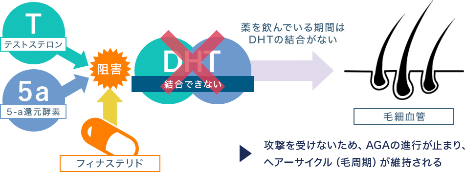 従来のAGA治療法 画像